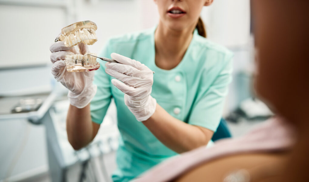 Jak przygotować się do zabiegu implantacji zębów?