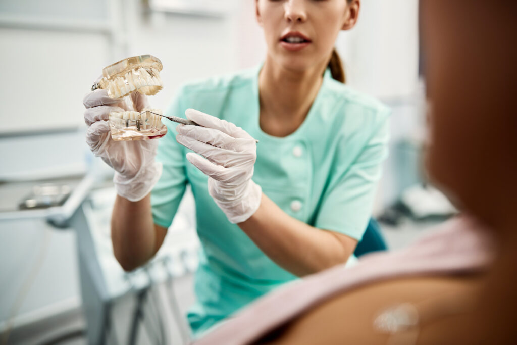 Jak przygotować się do zabiegu implantacji zębów?